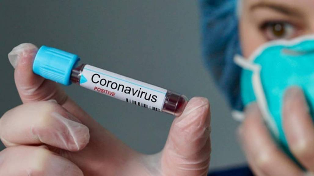 coronavírus (Agência Brasil/Arquivo) coronavírus (Agência Brasil/Arquivo)