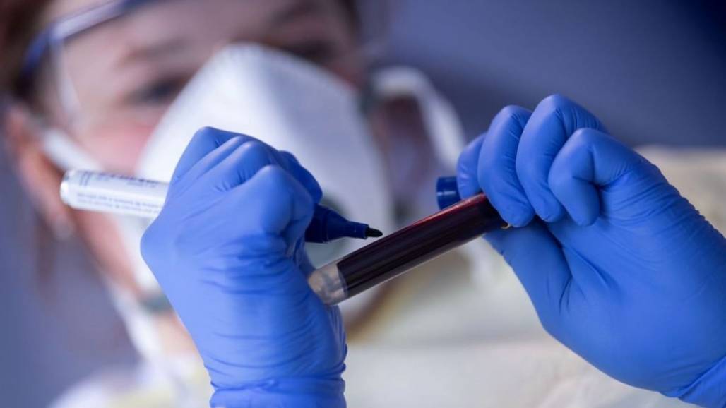 coronavirus-covid-reuters-1024x613 (Agência Brasil/Arquivo) coronavirus-covid-reuters-1024x613 (Agência Brasil/Arquivo)