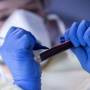 Brasil tem 140 mil mortes e 4,68 milhões de casos acumulados de Covid-19 Brasil tem 140 mil mortes e 4,68 milhões de casos acumulados de Covid-19