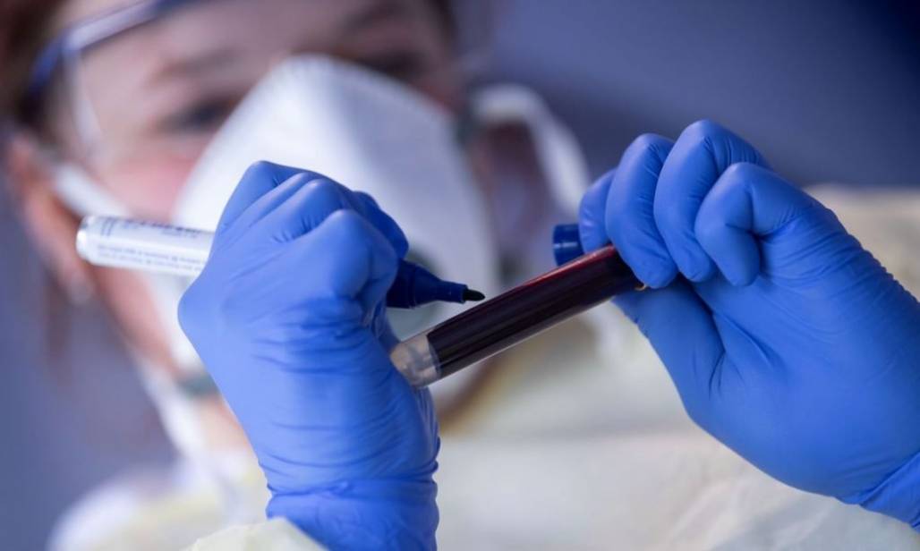 coronavirus-covid-reuters-1024x613 (Agência Brasil/Arquivo) coronavirus-covid-reuters-1024x613 (Agência Brasil/Arquivo)