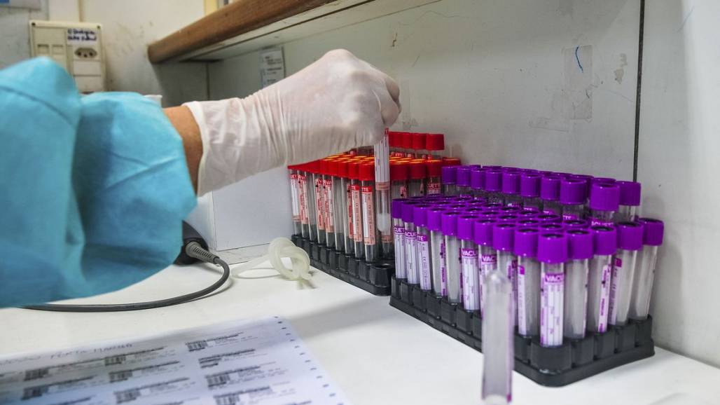 coronavirus (Reprodução/AgênciaBrasília/AcácioPinheiro) coronavirus (Reprodução/AgênciaBrasília/AcácioPinheiro)