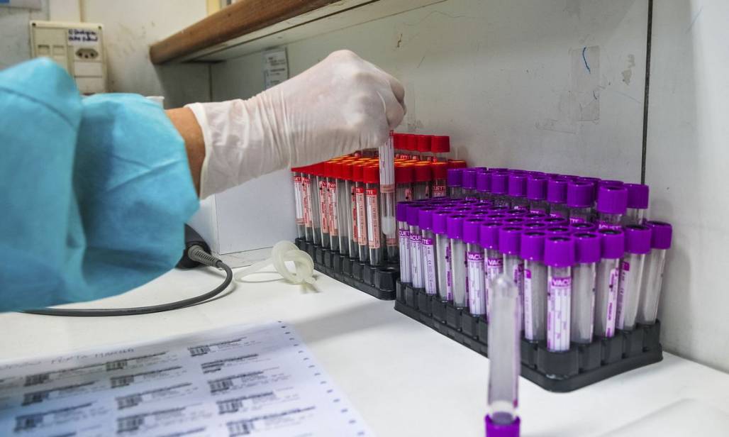 coronavirus (Reprodução/AgênciaBrasília/AcácioPinheiro) coronavirus (Reprodução/AgênciaBrasília/AcácioPinheiro)