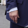 Trump é diagnosticado com insuficiência venosa crônica após inchaço