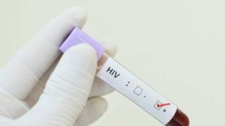 teste_do_hiv