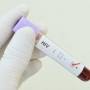 ONU alerta para aumento de infecções por HIV após cortes de verbas pelos EUA